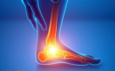 Laser Therapy: A Pioneering Approach