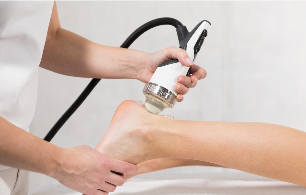 Clinician uses a handheld suction device on a bare foot during a medical/spa treatment, with a clear suction cup head.
