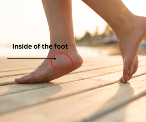 Posterior tibial tendon located on the inside of the foot.