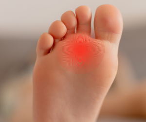 Painful ball of foot